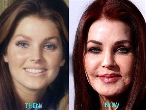 Priscilla Presley | Celebrity plastic surgery, Plastic surgery, Bad ...