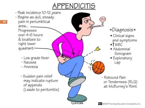 mcburney's point, peritonitis | Nursing mnemonics, Medical surgical nursing, Pediatric nursing