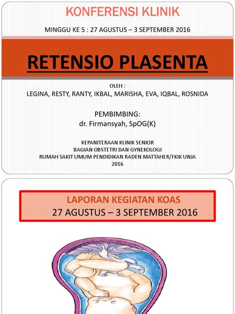 Retensio Plasenta | PDF