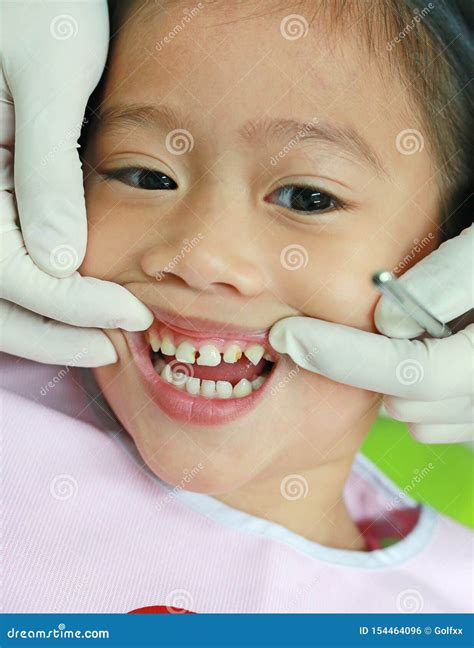 Close-up Little Girl during Dental Extraction. Child with a Teeth Broken and Rotten Stock Photo ...