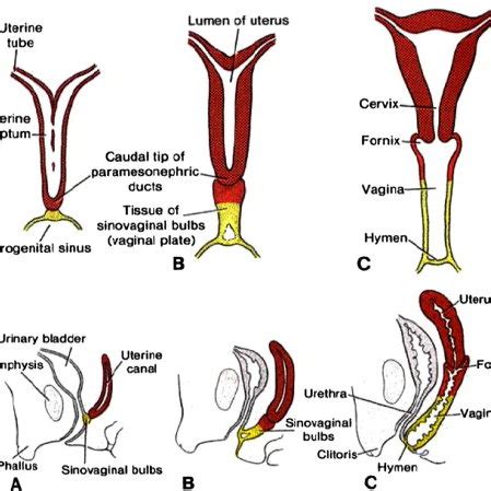 Unicornuate uterus in 32-years-old female patient. (A) TVUS shows... | Download Scientific Diagram