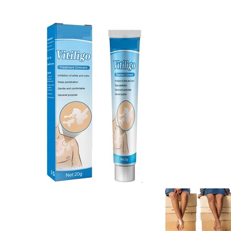 Buy Vitiligo Cream,White Spots Vitiligo ,White Spot Ointment,Ointment for White Spots,Sweat ...