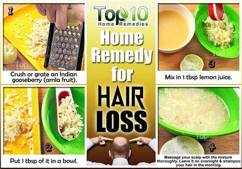 Home Remedies for Hair Loss | Top 10 Home Remedies