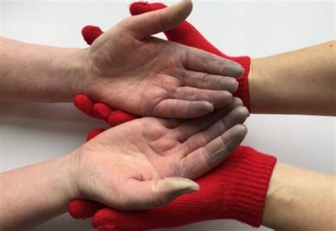 Best Gloves for Raynaud's Disease in 2022 - 9 Gloves for Typing, Running