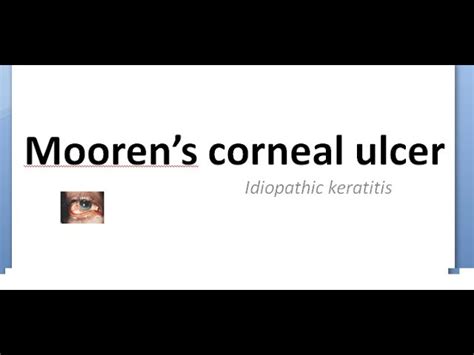 Moorens Ulcer