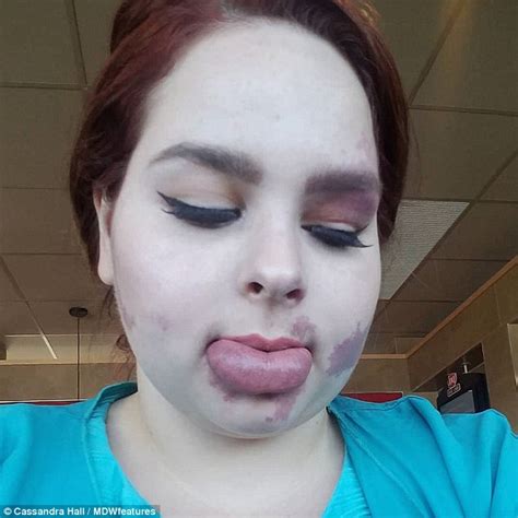 Waitress is asked if she's been PUNCHED due to her birthmark | Daily ...