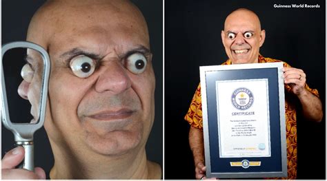 Brazilian man breaks Guinness World Record for ‘farthest eyeball pop’ | Trending News - The ...