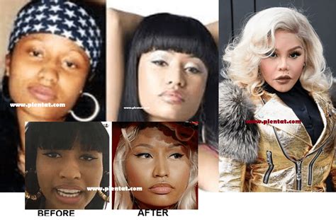 Nicki Minaj Before Plastic Surgery(Rapper, Singer, Writer, Model)