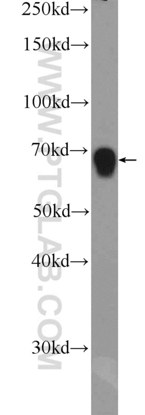 ZNF668 Rabbit anti-Human, Polyclonal, Proteintech:Antibodies:Primary Antibodies | Fisher Scientific