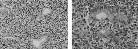 Histological examination of initial biopsy specimens from the duodenal... | Download Scientific ...