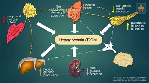 Type 2 Diabetes Mellitus - Pathophysiology