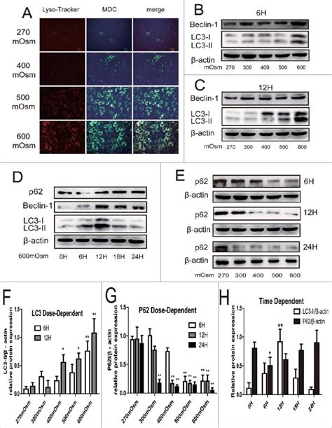 Typical LysoTracker Red staining, MDC staining, and Western blotting ...