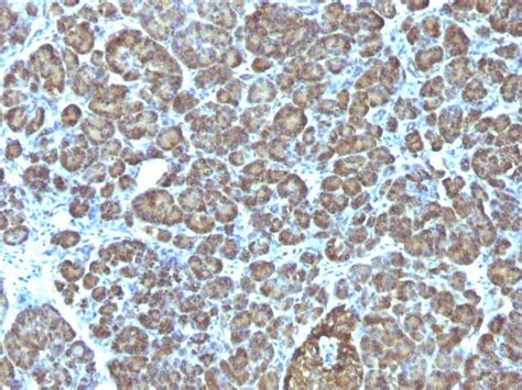 Anti-Mitochondria antibody [AE-1] (ab215892) | Abcam