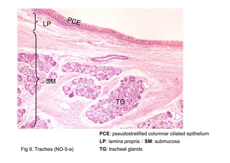 Trachea Histology Labeled Seromucous Glands