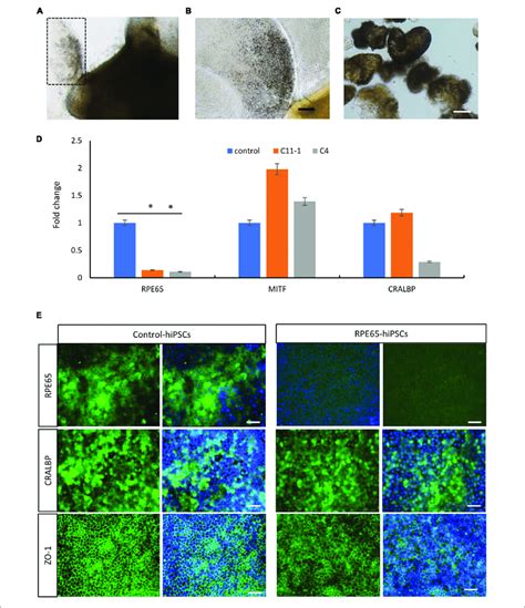 | Decreased expression of RPE65 in patient RPE cells. (A) Pigmented RPE... | Download Scientific ...