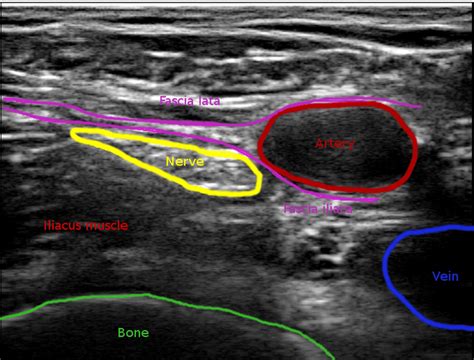 Top: Cross-section illustration of the region of interest (ROI). Image... | Download Scientific ...