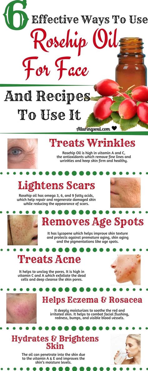 10 Benefits Of Rosehip Oil For Face And How To Use It | Tipps für die ...