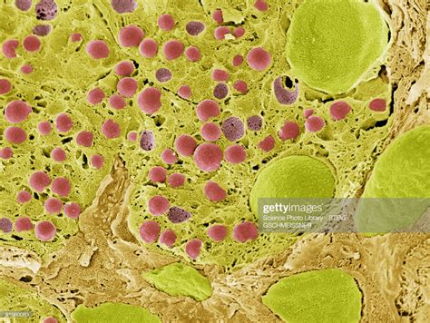 Pancreas Tissue Colored Scanning Electron Micrograph High-Res Vector ...