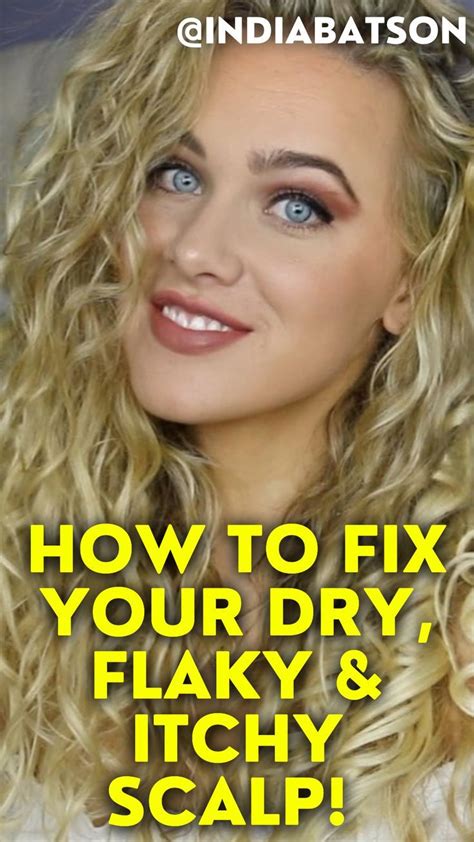 HOW TO FIX YOUR DRY, FLAKY & ITCHY SCALP! Dry Flaky Scalp, Itchy Scalp, Wavy Hair Care, Short ...