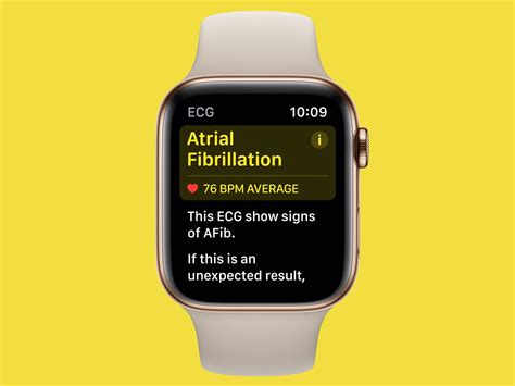 Apple’s Newest Watch Features Will Transform Heart Health | WIRED