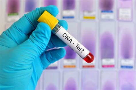 DNA Testing – Dr. Jones MD