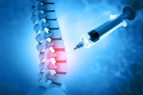 Spinal vs. Epidural Anesthesia - North Dakota Anesthesia Services