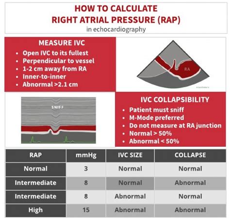 How to Estimate Right Atrial Pressure (RAP) Cardioserv