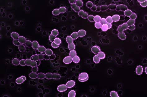 Lactic Acid Bacteria | Cider Academy