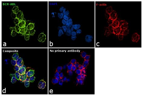 BCR-ABL Antibody (MA1-153)