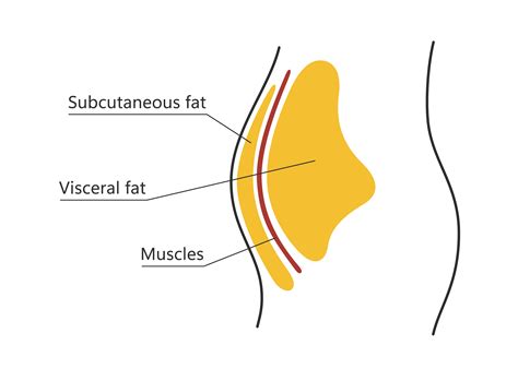 What is Subcutaneous Fat and How Can I Reduce It?