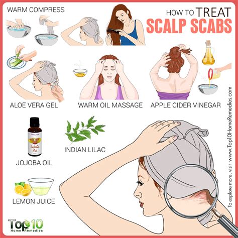 How to Treat Scalp Scabs | Top 10 Home Remedies | Scalp scabs, Dry ...