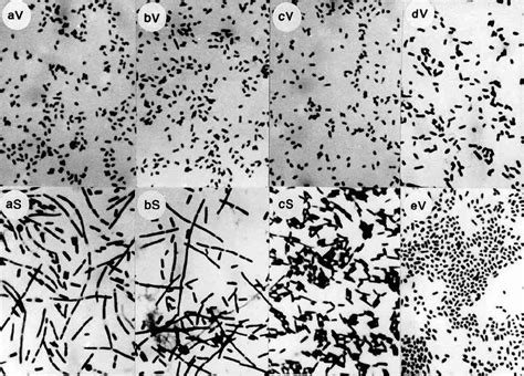 Microscopic observation of P. mirabilis P19 isolated from the LB agar ...