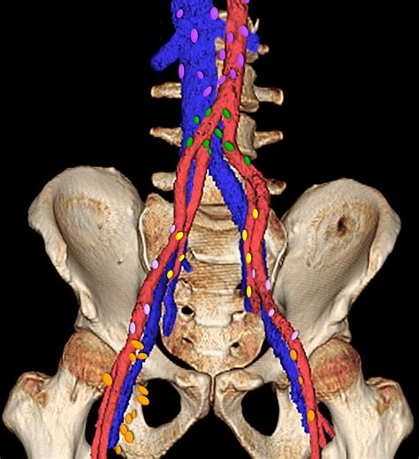 Retroperitoneal Lymph Nodes Anatomy