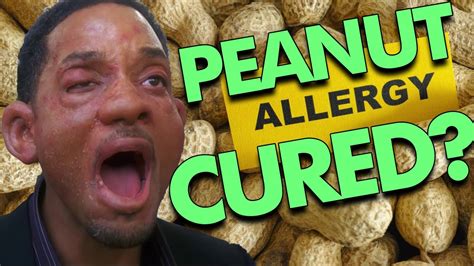 How I cured my Peanut Allergy in 6 weeks - YouTube