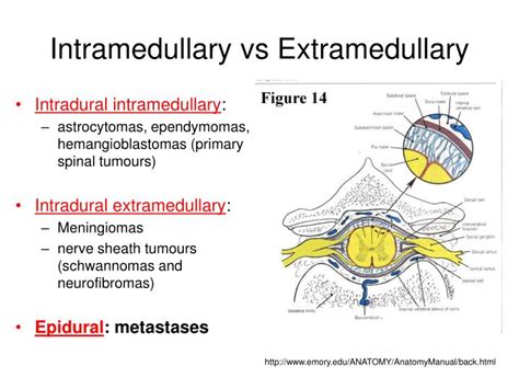 PPT - Spinal Cord Compression PowerPoint Presentation - ID:851177