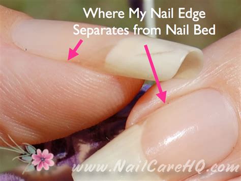 HANGNAIL TREATMENT: Ask Ana - Dealing With Hangnails - Bliss Kiss