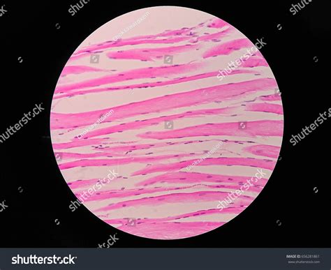 Histology Human Skeletal Muscle Under Microscope: foto de stock (editar ahora) 656281861