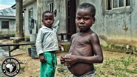 Hungry Children In Africa - Weeks left to save East Africa's starving ...