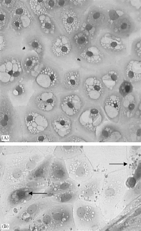 Human Epithelial Cells Light Microscope