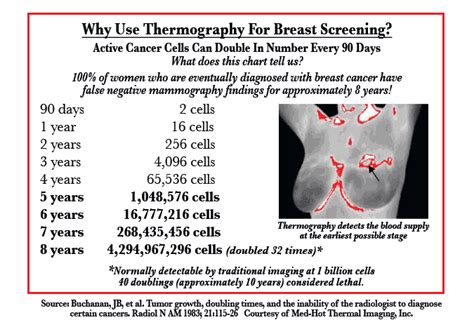 Thermography - SOPHIA Natural Health