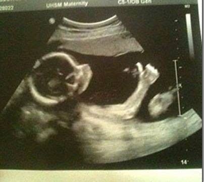 Cool Ultrasound, Bro. | Funny, Funny photos, Funny cartoons