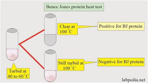 How To Detect Protein In Urine - Rowwhole3