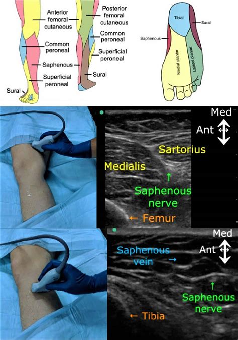 Nerve block uses, duration, nerve block procedure & side effects