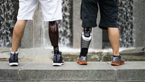 Παραμένει δέρμα Βασίλισσα 3d printed prosthetic leg ταλέντο Παραμέληση χαλαρότητα