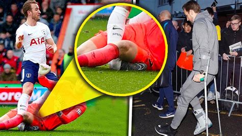 Harry Kane Injury - Harry Kane Injury Opta Numbers Suggest Spurs ...