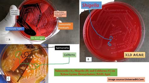 Xylose Lysine Deoxycholate (XLD) Agar : Introduction, Principle, Preparati