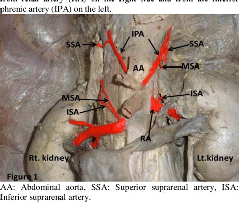 [PDF] Anatomical Variations in the Arterial Supply of the Suprarenal ...