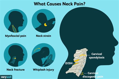 Neck Pain » RestoraLife | Causes and Treatment