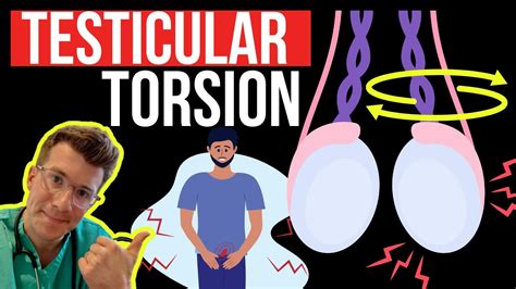 Doctor explains TESTICULAR TORSION (twisting of the testicle) | Symptoms, causes and surgery ...