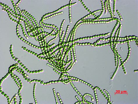 Nostoc Under A Microscope